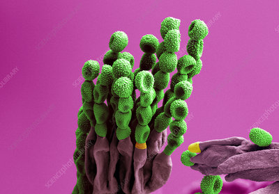 Penicillium Camemberti in microscopic view. 